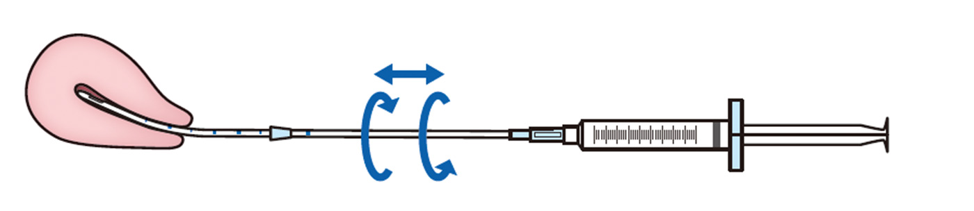 吸引後のイメージ画像