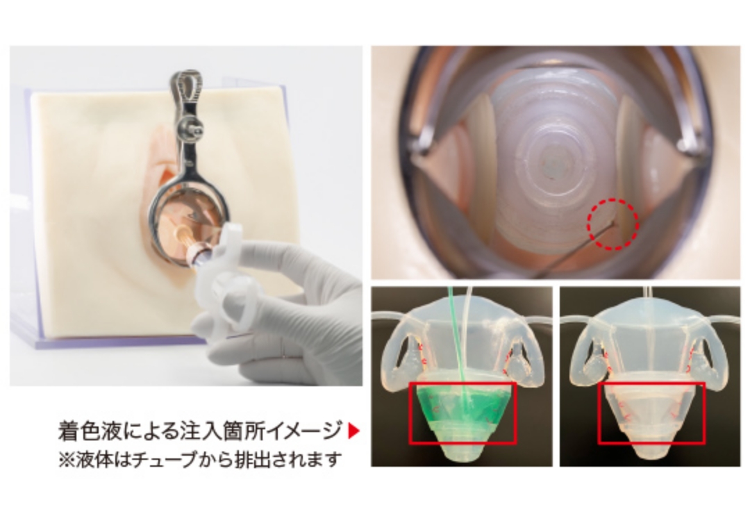 着色液による注入箇所イメージ